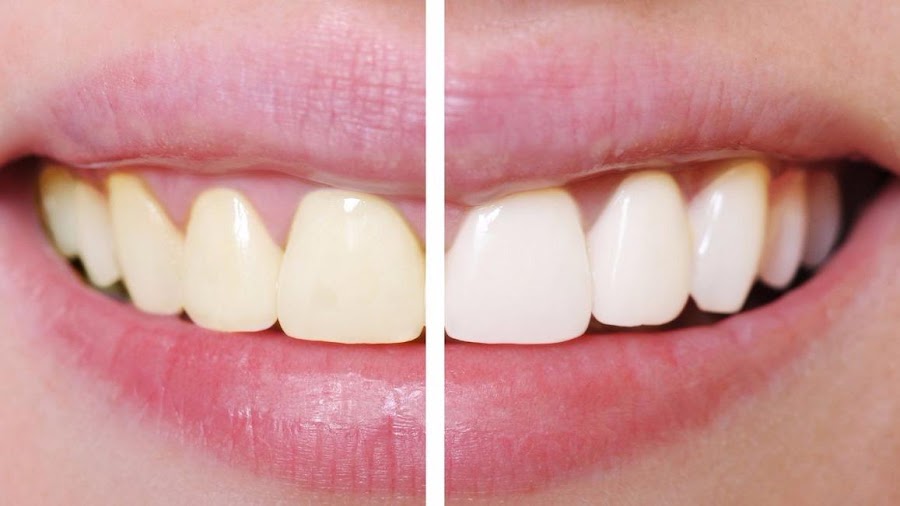 Montgomery Dental Care at 9563 Montgomery Rd #201